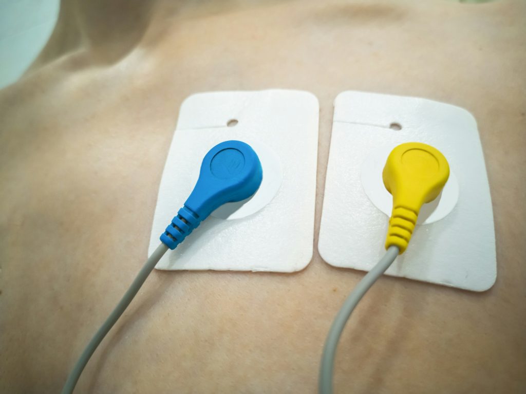 24-hour ECG recording. Holter monitoring. Blue and yellow Holter sensors - heart with Ukraine.